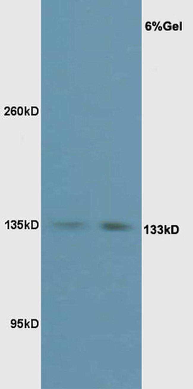 Phospho-eNOS (Thr495) Antibody in Western Blot (WB)