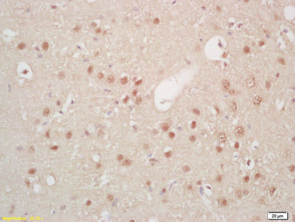 Hes5 Antibody in Immunohistochemistry (Paraffin) (IHC (P))