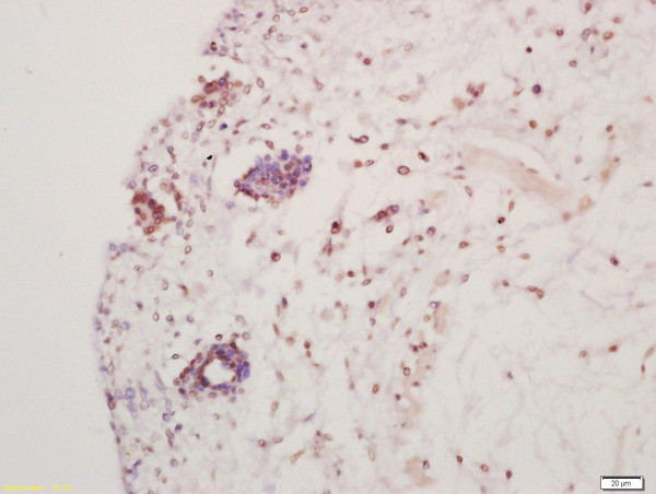 Hes5 Antibody in Immunohistochemistry (Paraffin) (IHC (P))