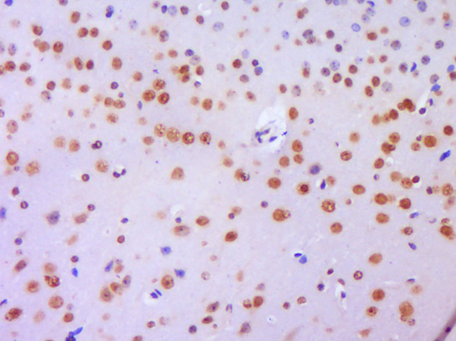 Histone H3 (Di methyl K36) Antibody in Immunohistochemistry (Paraffin) (IHC (P))