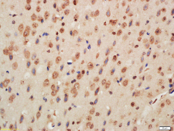 Histone H3 (Di methyl K9) Antibody in Immunohistochemistry (Paraffin) (IHC (P))