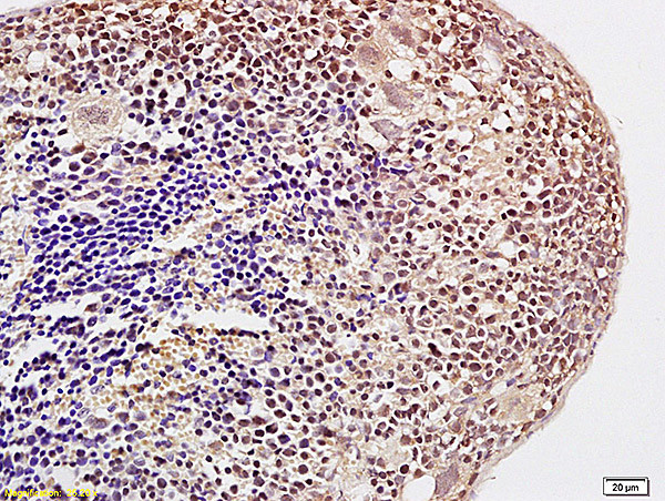 Acetyl-Histone H3 (Lys23) Antibody in Immunohistochemistry (Paraffin) (IHC (P))