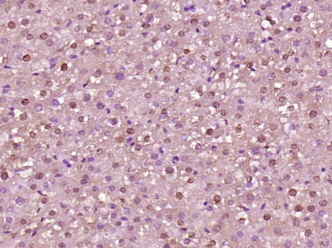 Acetyl-Histone H3 (Lys23) Antibody in Immunohistochemistry (Paraffin) (IHC (P))