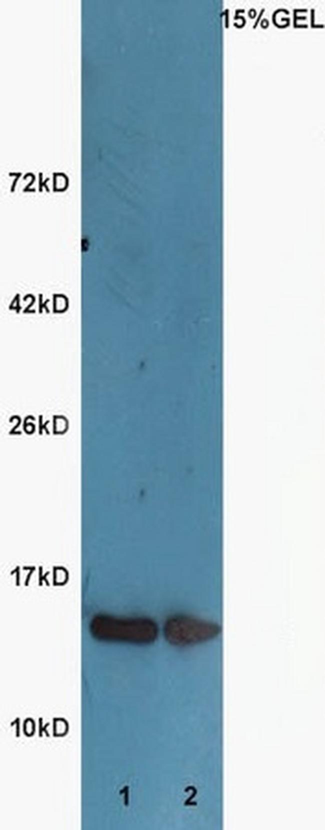 Acetyl-Histone H3 (Lys9) Antibody in Western Blot (WB)