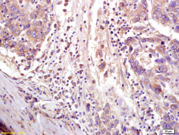 CTCF Antibody in Immunohistochemistry (Paraffin) (IHC (P))