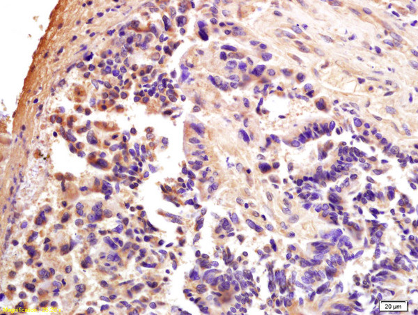 CTCF Antibody in Immunohistochemistry (Paraffin) (IHC (P))