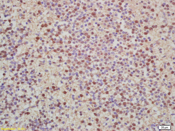 Histone H2A Antibody in Immunohistochemistry (Paraffin) (IHC (P))