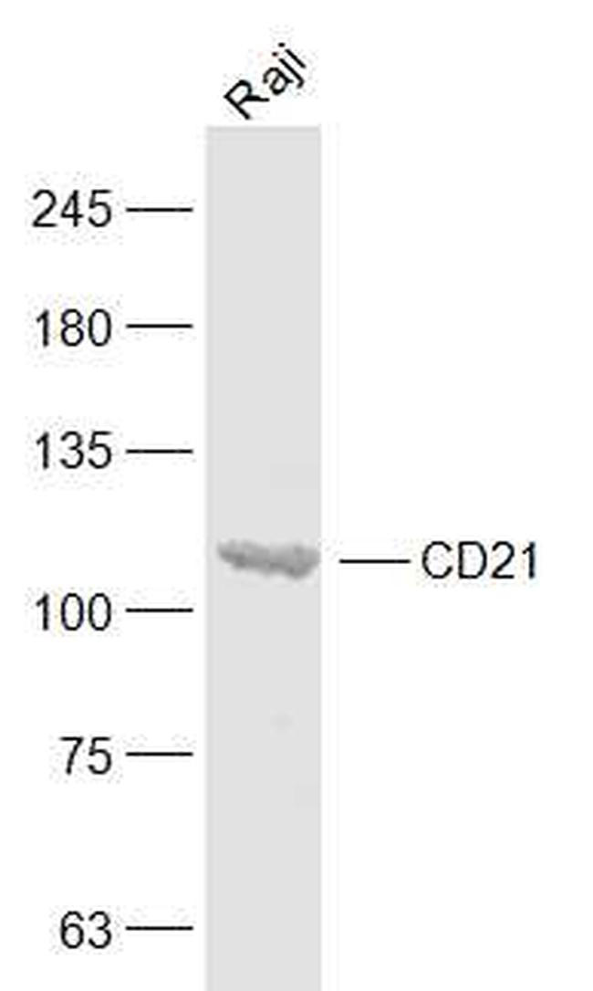 CD21/EBV receptor Antibody in Western Blot (WB)