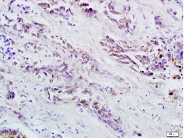 Oct-4BOCT4B-190NT Antibody in Immunohistochemistry (Paraffin) (IHC (P))