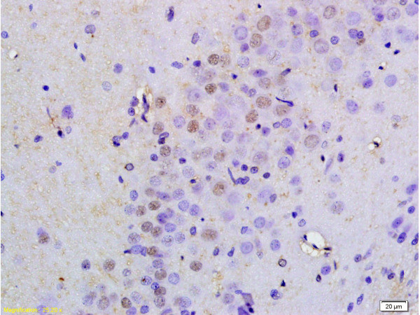 Oct-4BOCT4B-190NT Antibody in Immunohistochemistry (Paraffin) (IHC (P))