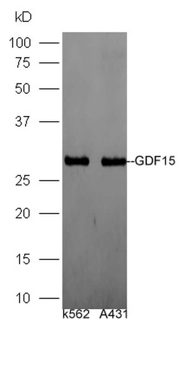 GDF15/MIC-1 Antibody in Western Blot (WB)