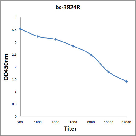 JMJD1B Antibody in ELISA (ELISA)