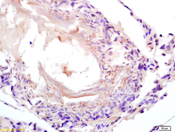 Lactate Dehyrdrogenase Antibody in Immunohistochemistry (Paraffin) (IHC (P))