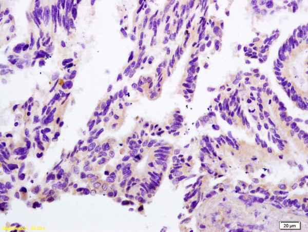 Lactate Dehyrdrogenase Antibody in Immunohistochemistry (Paraffin) (IHC (P))