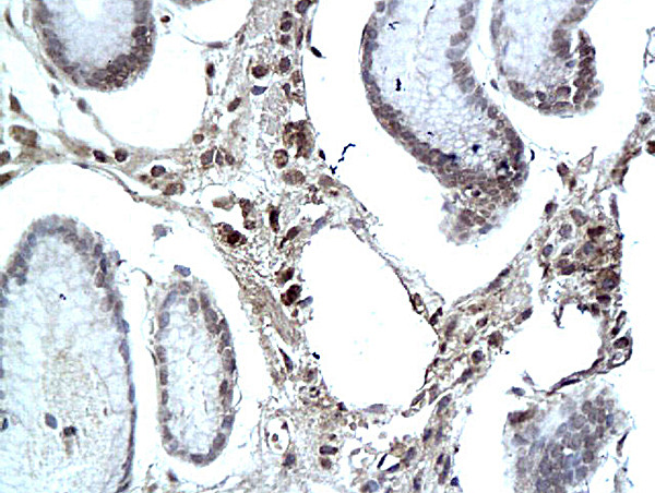 e3F Antibody in Immunohistochemistry (Paraffin) (IHC (P))