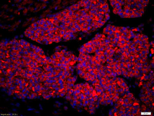 Amphiregulin Antibody in Immunohistochemistry (Paraffin) (IHC (P))