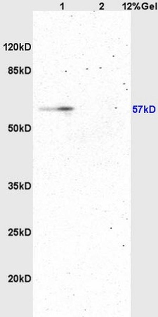 ATG13 Antibody in Western Blot (WB)