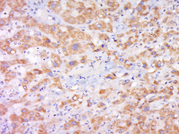 Cytochrome b245 Light Chain Antibody in Immunohistochemistry (Paraffin) (IHC (P))