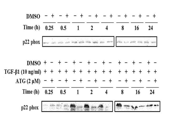 Cytochrome b245 Light Chain Antibody in Western Blot (WB)