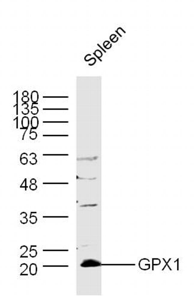 GPX1 Antibody in Western Blot (WB)