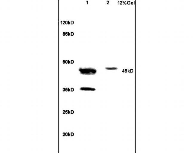 NCF1/p47 phox Antibody in Western Blot (WB)