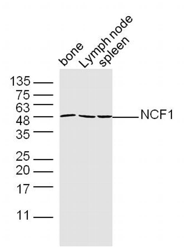 NCF1/p47 phox Antibody in Western Blot (WB)