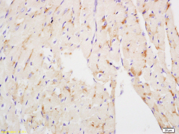 NDUFS3 Antibody in Immunohistochemistry (Paraffin) (IHC (P))