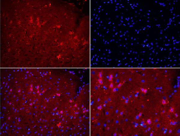 NOX2/gp91phox Antibody in Immunohistochemistry (Paraffin) (IHC (P))