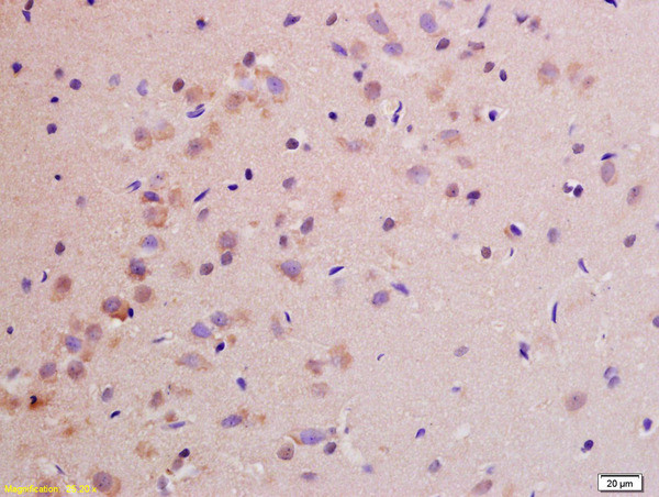 NDUFS1 Antibody in Immunohistochemistry (Paraffin) (IHC (P))