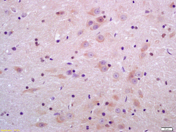 Sulfatase 2 Antibody in Immunohistochemistry (Paraffin) (IHC (P))