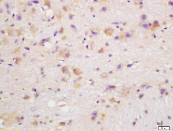 CYP24A1 Antibody in Immunohistochemistry (Paraffin) (IHC (P))