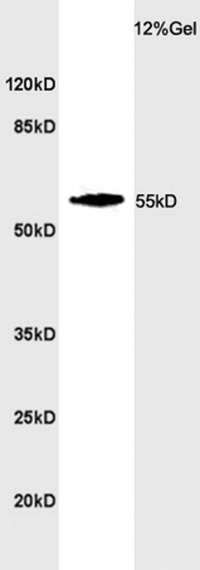 CYP24A1 Antibody in Western Blot (WB)