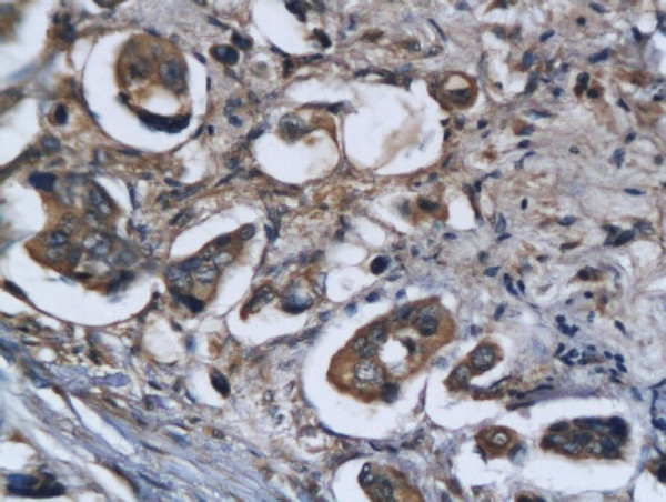 Legumain Antibody in Immunohistochemistry (Paraffin) (IHC (P))