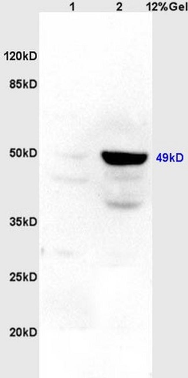 Legumain Antibody in Western Blot (WB)