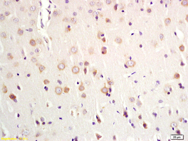 MSH gamma 1 Antibody in Immunohistochemistry (Paraffin) (IHC (P))