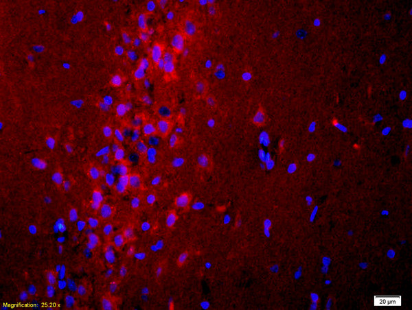 ADCY10 Antibody in Immunohistochemistry (Paraffin) (IHC (P))