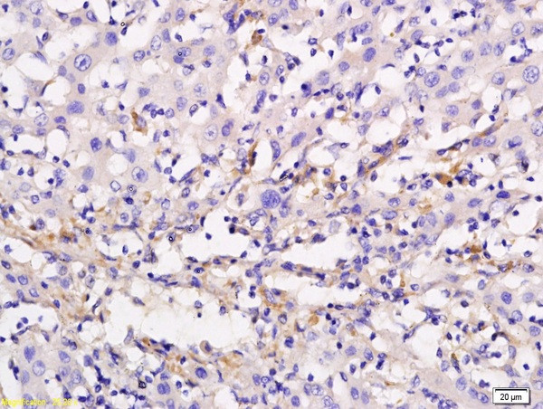 ADCY10 Antibody in Immunohistochemistry (Paraffin) (IHC (P))