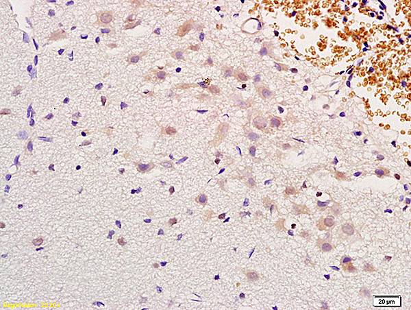 MSH gamma Antibody in Immunohistochemistry (Paraffin) (IHC (P))