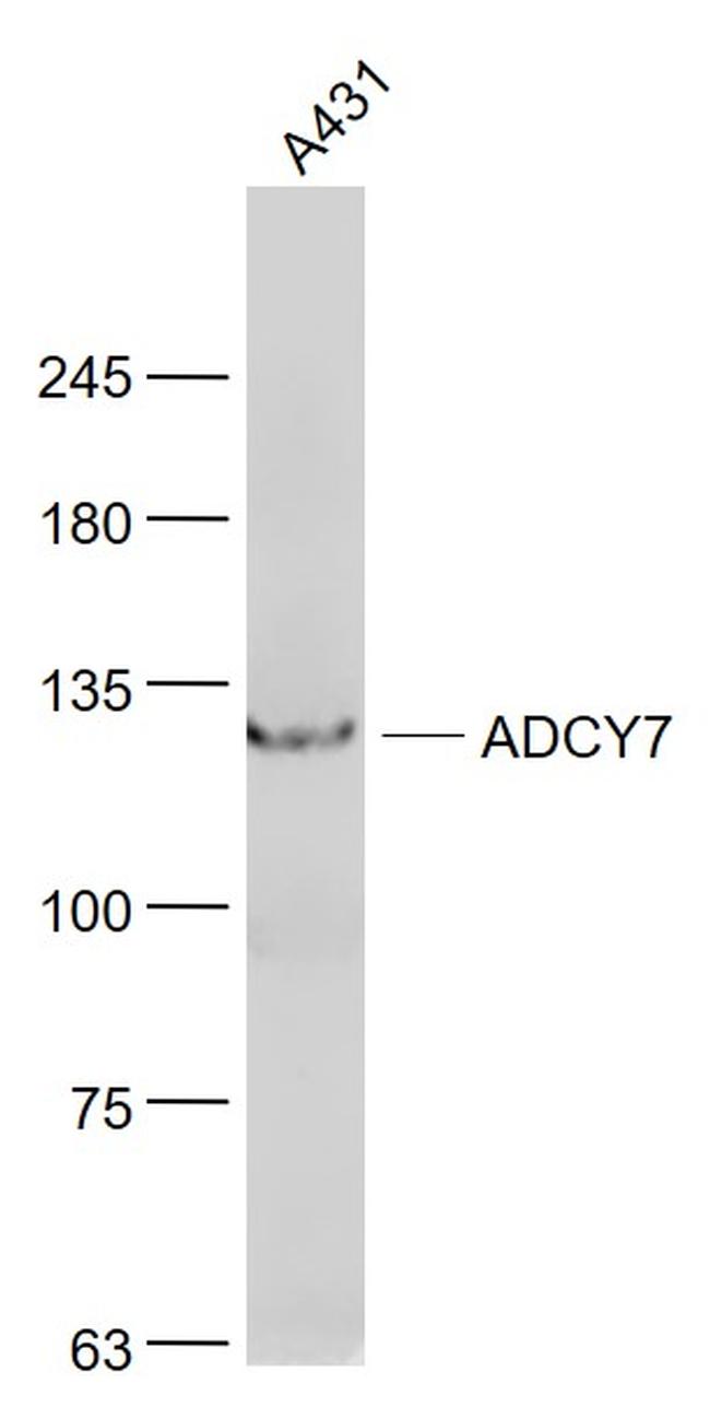 ADCY7 Antibody in Western Blot (WB)