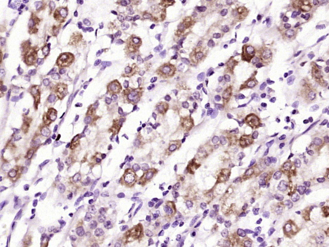 Glucagon Receptor Antibody in Immunohistochemistry (Paraffin) (IHC (P))