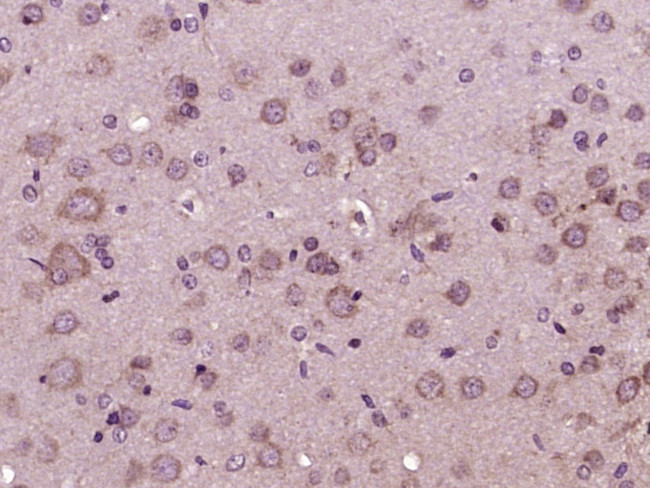 Glucagon Receptor Antibody in Immunohistochemistry (Paraffin) (IHC (P))