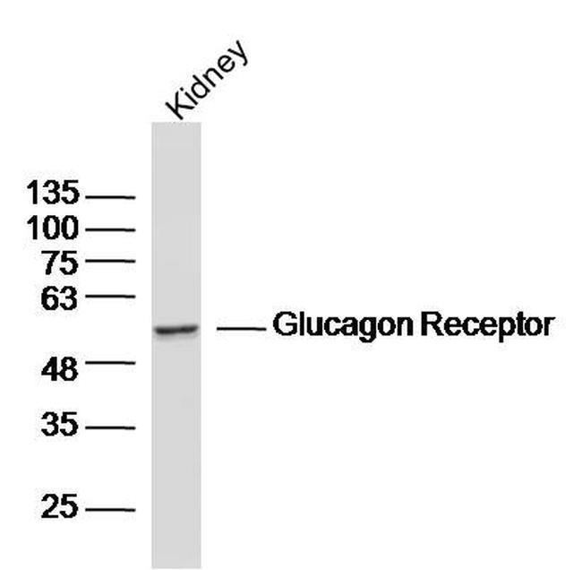 Glucagon Receptor Antibody in Western Blot (WB)