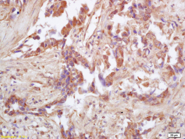 IDH2 Antibody in Immunohistochemistry (Paraffin) (IHC (P))