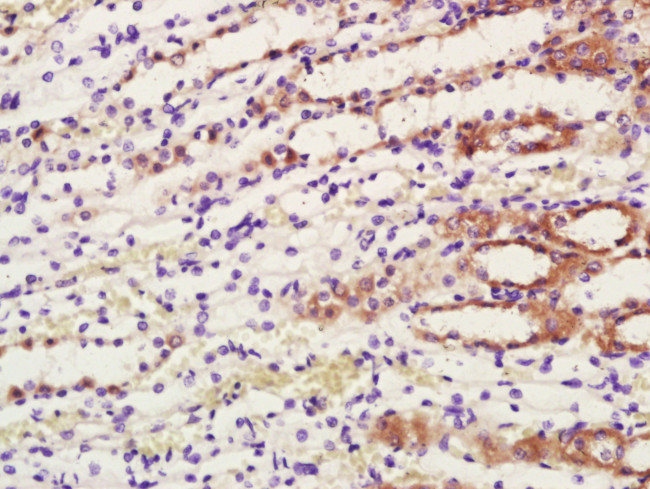 COX1/MTCO1 Antibody in Immunohistochemistry (Paraffin) (IHC (P))