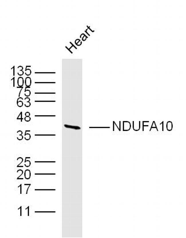 NDUFA10 Antibody in Western Blot (WB)