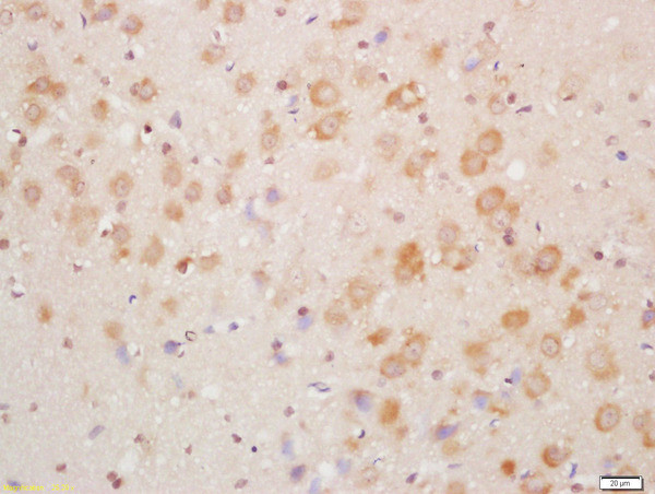 NDUFA8 Antibody in Immunohistochemistry (Paraffin) (IHC (P))