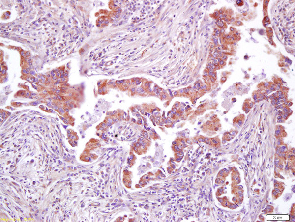 AMPK beta 1 + 2 Antibody in Immunohistochemistry (Paraffin) (IHC (P))