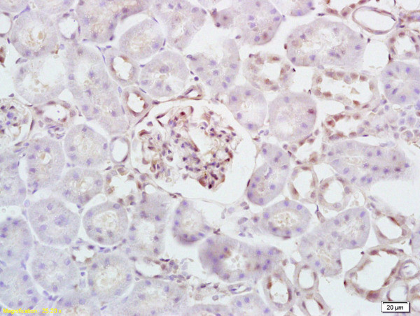 HK/Hexokinase 1 Antibody in Immunohistochemistry (Paraffin) (IHC (P))