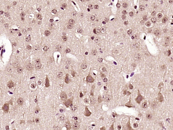 Phospho-AMPK alpha-1/2 (Thr172, Thr183) Antibody in Immunohistochemistry (Paraffin) (IHC (P))