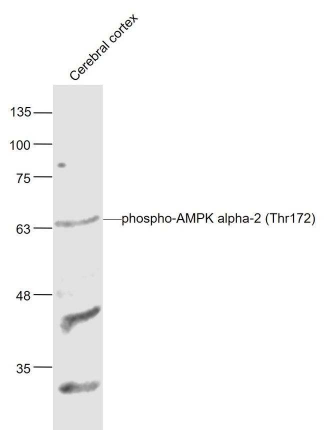 Phospho-AMPK alpha-1/2 (Thr172, Thr183) Antibody in Western Blot (WB)